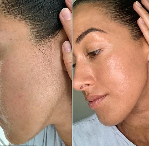 DEPIL FACE  -  O removedor de pelos e células mortas Facial - 10 Peças